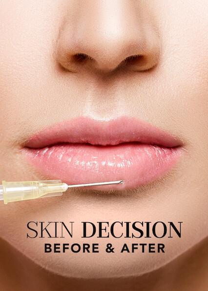 Poster för Skin Decision: Before and After