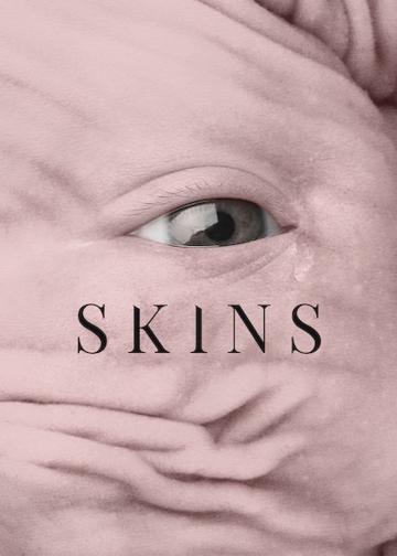 Skins poszter