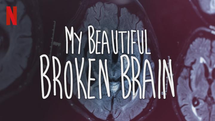 Poster of My Beautiful Broken Brain